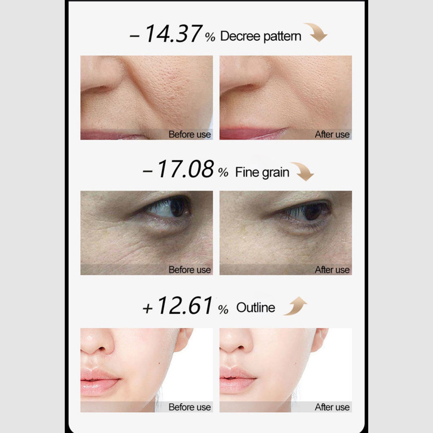 EMS+RF Facial Beauty Device Firming & Wrinkle Reduction