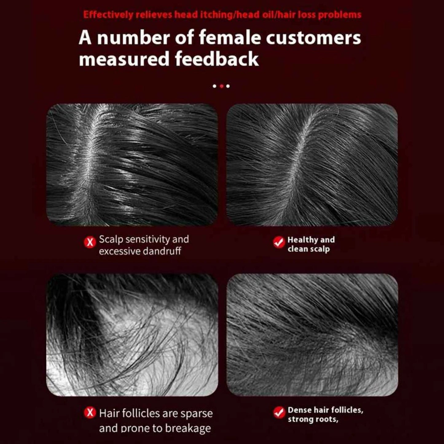 Spray Massage Comb – Hair Growth & Scalp Massager Anti-Static Ionic Technology