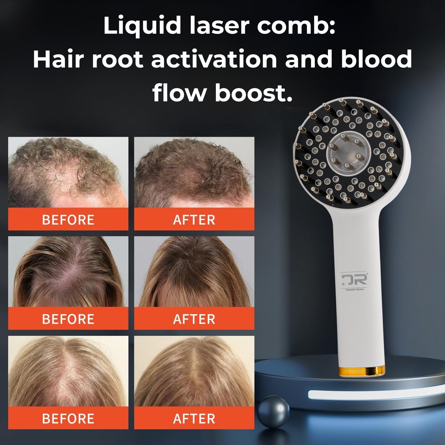 Hair Growth & Massaging Brush | Laser Guided Liquid Comb