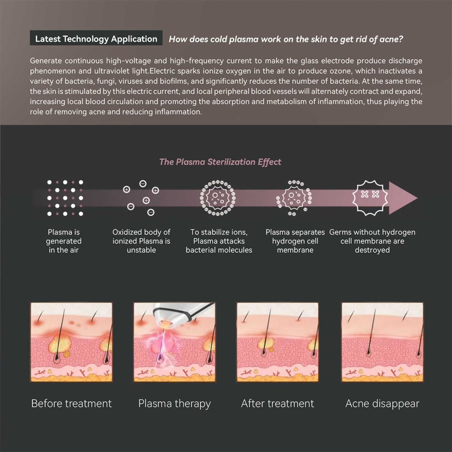 Plasma Acne Removal Device – Ionic Face Massager & Skin Revitalizer