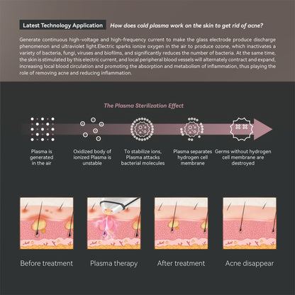 Plasma Acne Removal Device – Ionic Face Massager & Skin Revitalizer