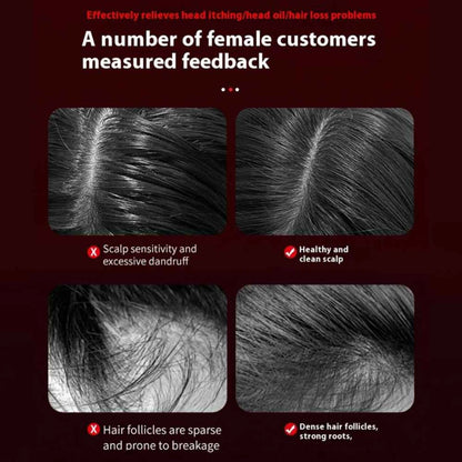 Spray Massage Comb – Hair Growth & Scalp Massager Anti-Static Ionic Technology