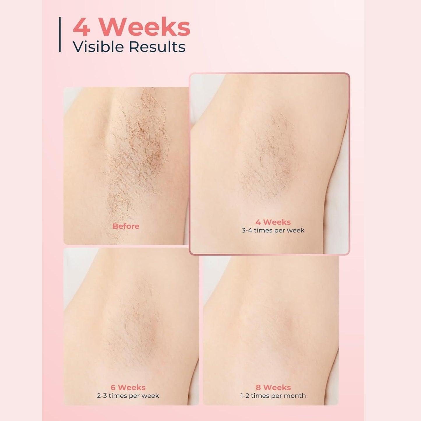 Laser Hair Removal Device  For Full Body Sapphire Double Freezing Point Depilator Green