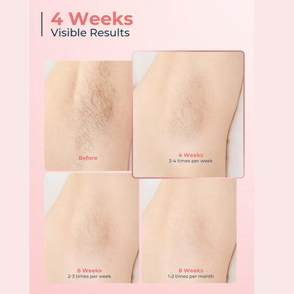 Laser Hair Removal Device  For Full Body Sapphire Double Freezing Point Depilator Green
