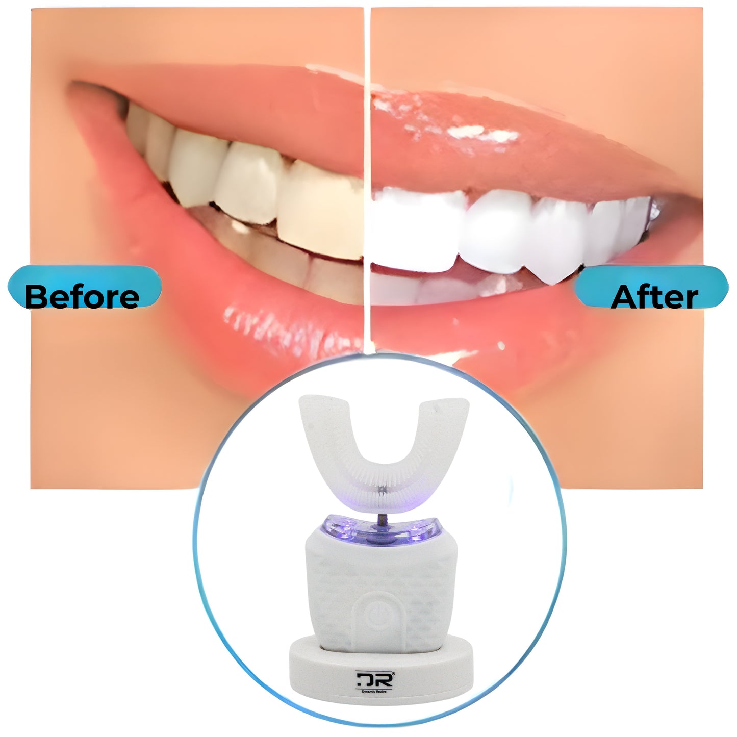 U-Shaped Electric Toothbrush with Massaging | 4 Modes, 360° Cleaning, Wireless Charging, IPX7 Waterproof