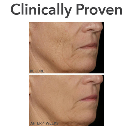 3D Silicone LED Light Therapy Mask – Skin Rejuvenation, Anti-Aging & Brightening