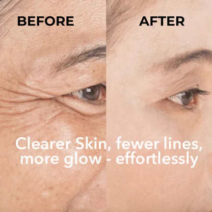 LED Photon Skin Therapy Mask – Anti-Aging, Collagen & Skin Repair
