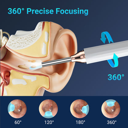 Smart Ear Wax Cleaner 1080P HD Wireless Otoscope